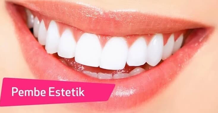 Pembe Estetik Nedir?