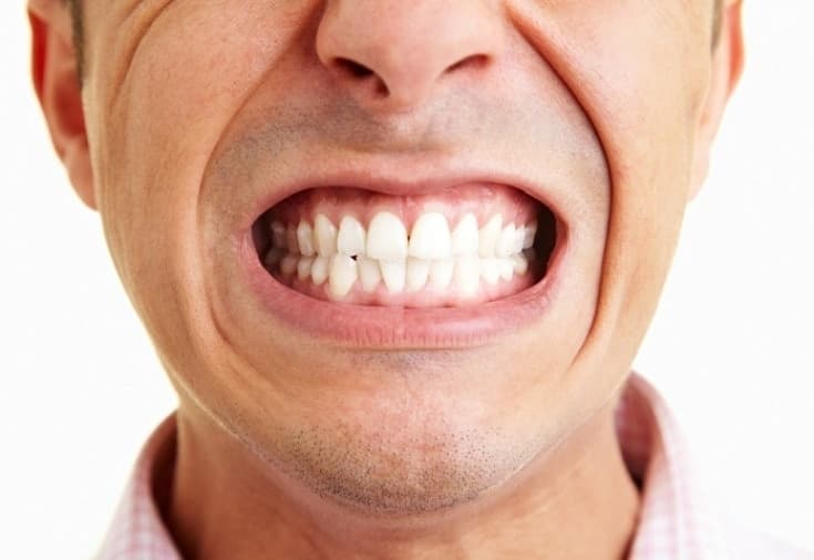 Ağız Ve Diş Sağlığı İçin Ele Alınması Gerekenler Nelerdir?