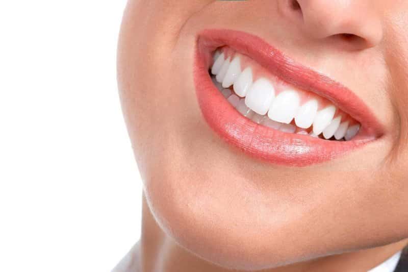 invisalign tedavisi