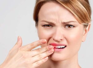 Kırık Diş Tedavisi Yöntemleri Nelerdir?