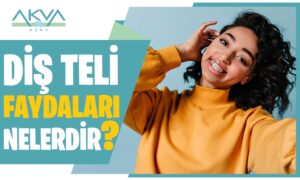 Diş Teli Faydaları Nelerdir?