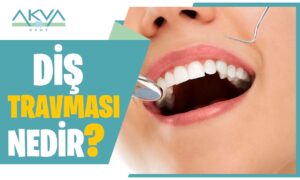 Diş Travması Nedir?