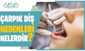 Çarpık Diş Nedenleri Nelerdir?