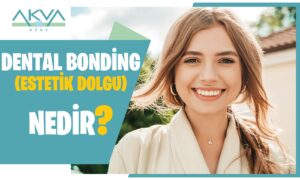 Dental Bonding (Estetik Dolgu) Nedir?