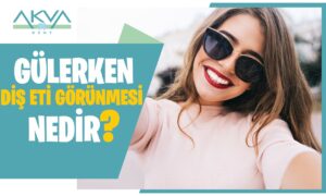 Gülerken Diş Eti Görünmesi Nedir?