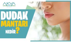 Dudak Mantarı Nedir?