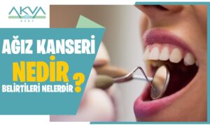 Ağız Kanseri Nedir? Ağız Kanseri Belirtileri Nelerdir?