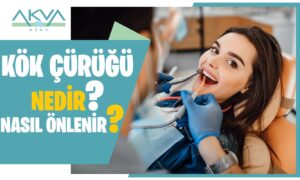 Kök Çürüğü Nedir? Kök Çürüğü Nasıl Önlenir?