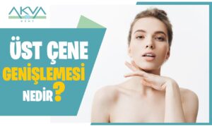 Üst Çene Genişletmesi Nedir?