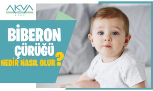 Biberon Çürüğü Nedir? Biberon Çürüğü Nasıl Oluşur?