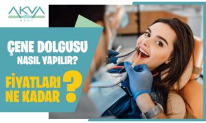 Çene Dolgusu Nedir? Çene Dolgusu Fiyatları Ne Kadar?