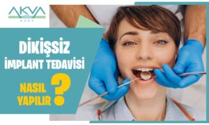 Dikişsiz İmplant Nedir? Dikişsiz İmplant Tedavisi