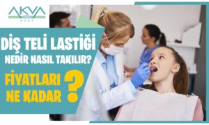 Diş Teli Lastiği Nedir? Diş Teli Lastiği Nasıl Takılır?