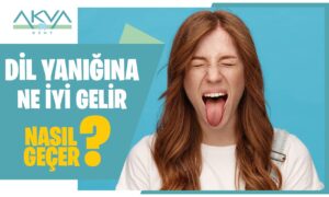 Dil Yanığına Ne İyi Gelir?