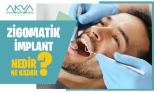 Zigomatik İmplant Nedir?