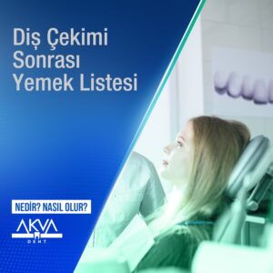 Diş Çekimi Sonrası Yemek Listesinde Neler Olmalı?