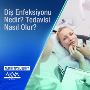 Diş Enfeksiyonu Nedir? Diş Enfeksiyonu Nedenleri, Belirtileri ve Tedavisi