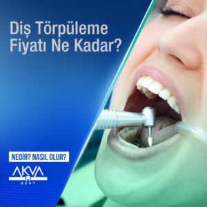 Diş Törpüleme Fiyatı Ne Kadar?