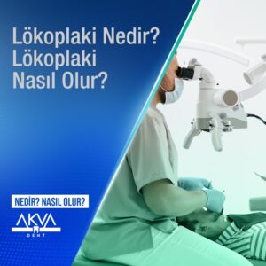Lökoplaki Nedir? Lökoplaki Tedavisi Nasıl Olur?